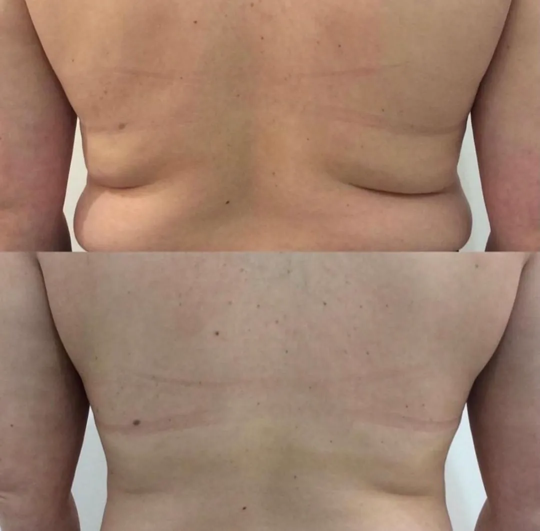 Client-supplied back fat before-and-after comparison 3
