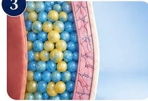 Illustration of CoolSculpting stage 3: Let your body work