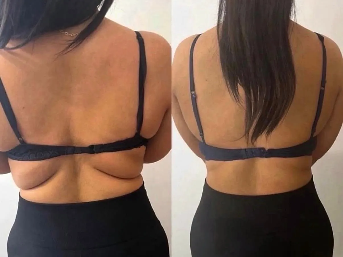 Client-supplied back fat before-and-after comparison 1