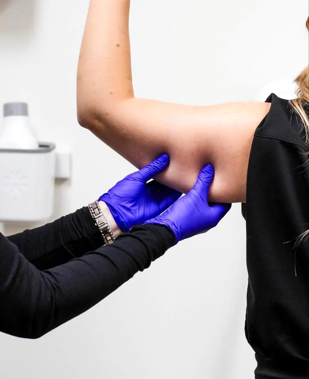 Assessing a client's upper arm during a CoolSculpting consultation