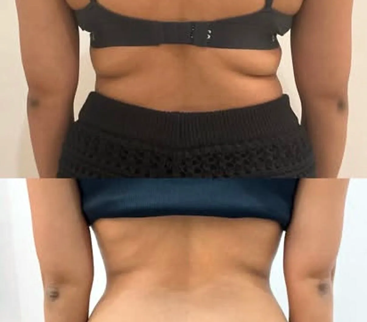 Client-supplied back fat before-and-after comparison 2